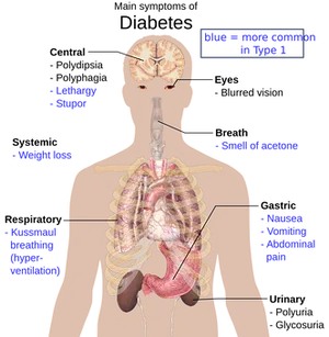 Diabetic Ketoacidosis Symptoms Infographic PNG Image