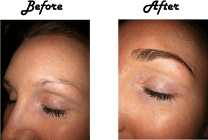 Eyebrow_ Transformation_ Before_ After.png PNG image with transparent background