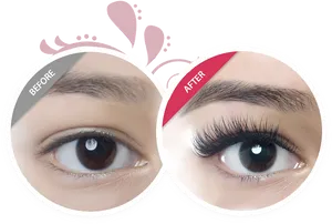 Eyelash Enhancement Comparison PNG Image