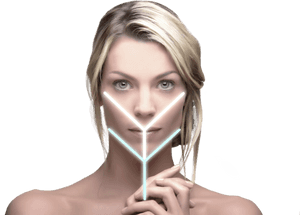 Y Lift Facelift Procedure, HD Png Download PNG with transparent background