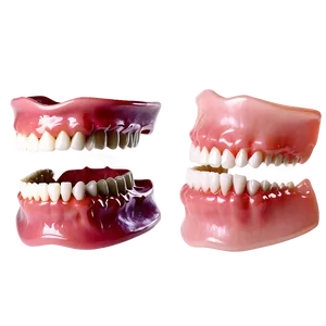 Flexible Dentures Png Naa PNG Image