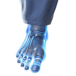 Frostbitten Foot Image PNG rkm PNG image with transparent background