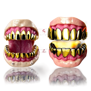 Gold Grillz Fitting Guide Png 06282024 PNG Image