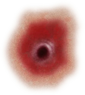 Gunshot Wound Closeup PNG Image