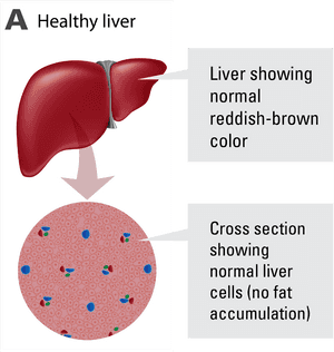 Healthy Liver Structureand Cells PNG with transparent background