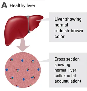 Healthy Liver Structureand Cells PNG Image