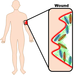 Human Anatomy Wound Diagram PNG Image
