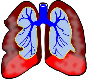 Human Lungs Illustration PNG Image