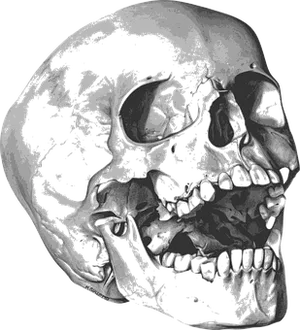 Human Skull Xray Image PNG Image