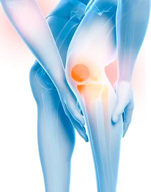 Knee Pain Illustration.jpg PNG Image