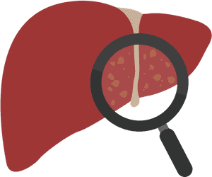 Liver Health Examination Concept PNG with transparent background