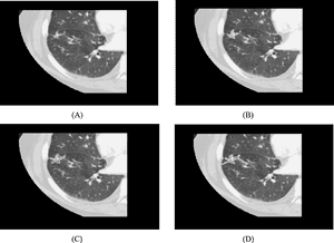 White Outline Shows Contour From Three Different Readers - Lung PNG image with transparent background