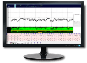 Heart Rate Trending - Computer Monitor, HD Png Download PNG image with transparent background
