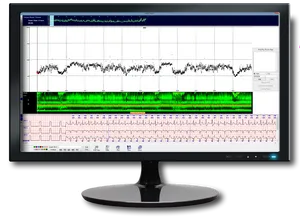Medical Monitor Displaying Heart Rateand Sleep Data PNG Image