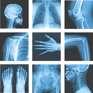 Medical_ X Ray_ Collage PNG