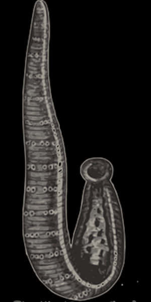 Microscopic Blood Fluke Schistosoma PNG image with transparent background