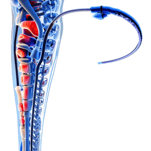 Minimally Invasive Surgery PNG oiw PNG with transparent background