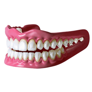 Orthodontic Braces PNG pyc33 PNG with transparent background