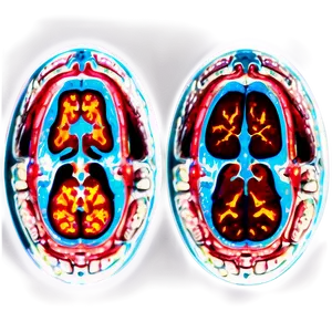 Realistic Mri Image Free Png 06252024 PNG Image