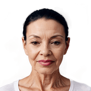 Skin Tightening for Wrinkles PNG 95 PNG with transparent background