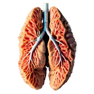 Smoker's Lung Comparison Png 59 PNG Image