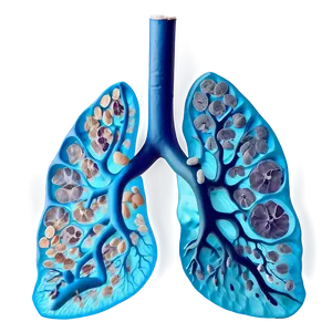 Smoker's Lung Comparison Png Wjq PNG Image