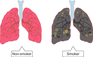 In The Lungs, The Cells That Line The Bronchi Produce - Smokers Lungs Png Transparent, Png Download PNG