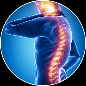 Spine Injury, HD Png Download PNG image with transparent background