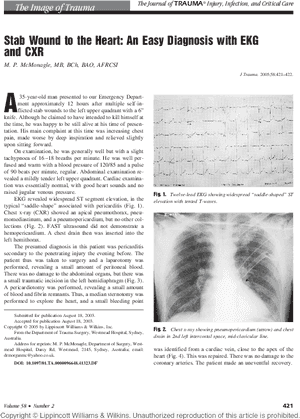 Document, HD Png Download PNG with transparent background