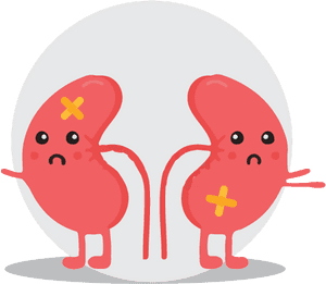 Kidney-stone - Kidney Stone Animation, HD Png Download PNG with transparent background
